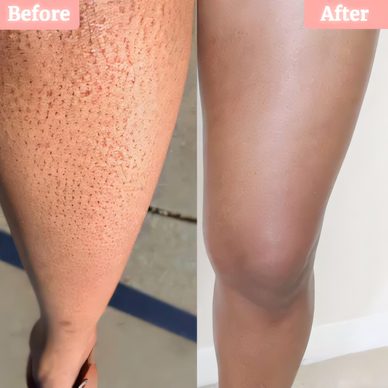 Auna® – Trimmer Razor 2.0