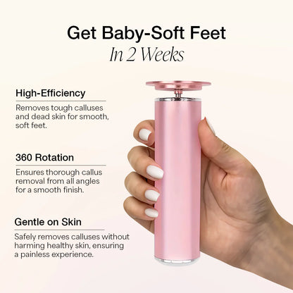 Auna® – Electric Foot Callus Remover